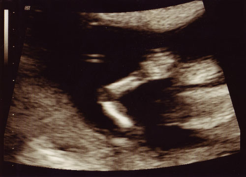 Baby, 13 weeks